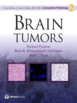 cover image of Brain Tumors